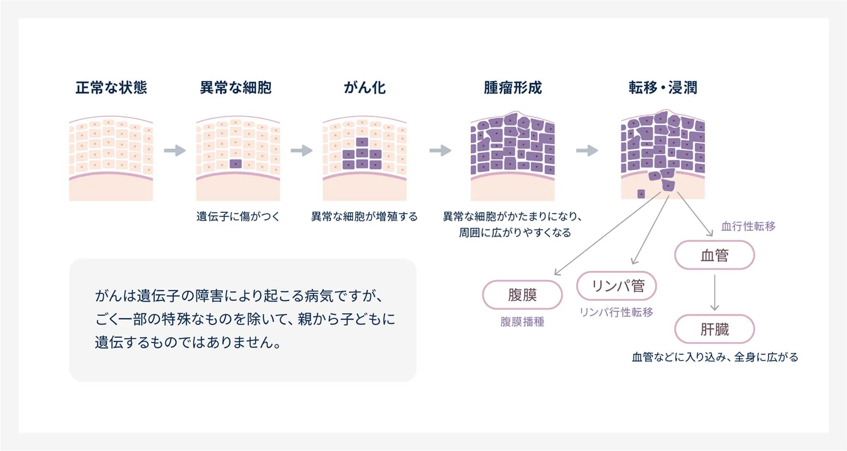がんに関して解説した図